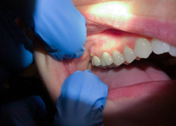 Best Emergency Treatment for Toothache in Magee, MS
